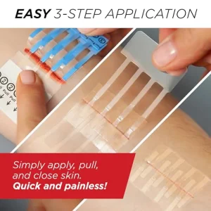 Clozex Emergency Laceration Closure Only- Close Wounds Without Stitches with This Surgical-Grade Skin Device. Available in 3 Variations for Wounds up to 1.0â or 3.5â. Life Happens, Be