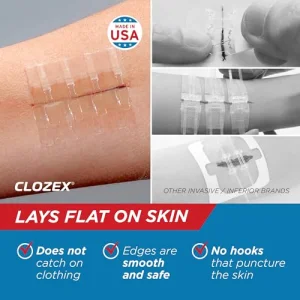 Clozex Emergency Laceration Closure Only- Close Wounds Without Stitches with This Surgical-Grade Skin Device. Available in 3 Variations for Wounds up to 1.0â or 3.5â. Life Happens, Be