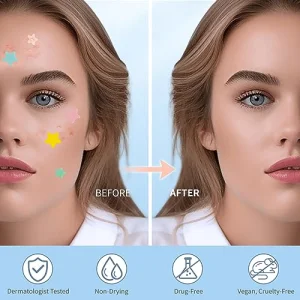 Pimple Patches for Face, Hydrocolloid Acne Patches, Cute Star Zit Covers, Colorful Spot Stickers with Tea Tree, Salicylic Acid & Cica Oil| 3 Sizes (10mm, 12mm & 14mm) |200